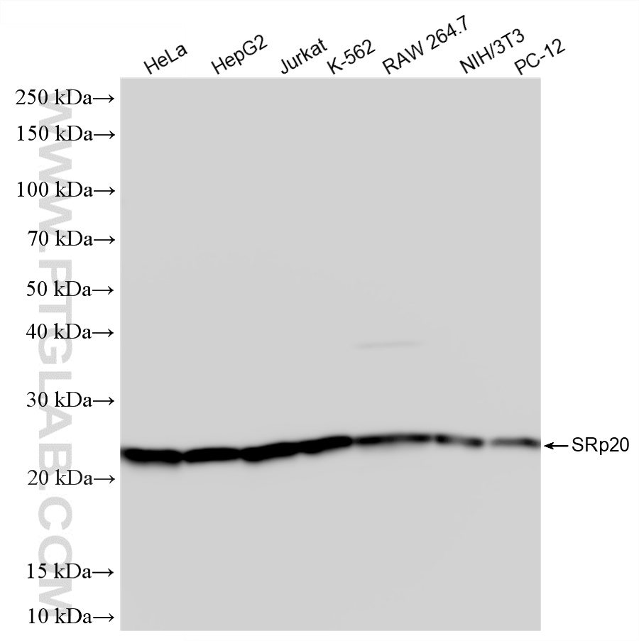 Various lysates were subjected to SDS PAGE followed by western blot with 87438-1-RR (SRp20 antibody) at dilution of 1:10000 incubated at room temperature for 1.5 hours. WB analysis using 87438-1-RR