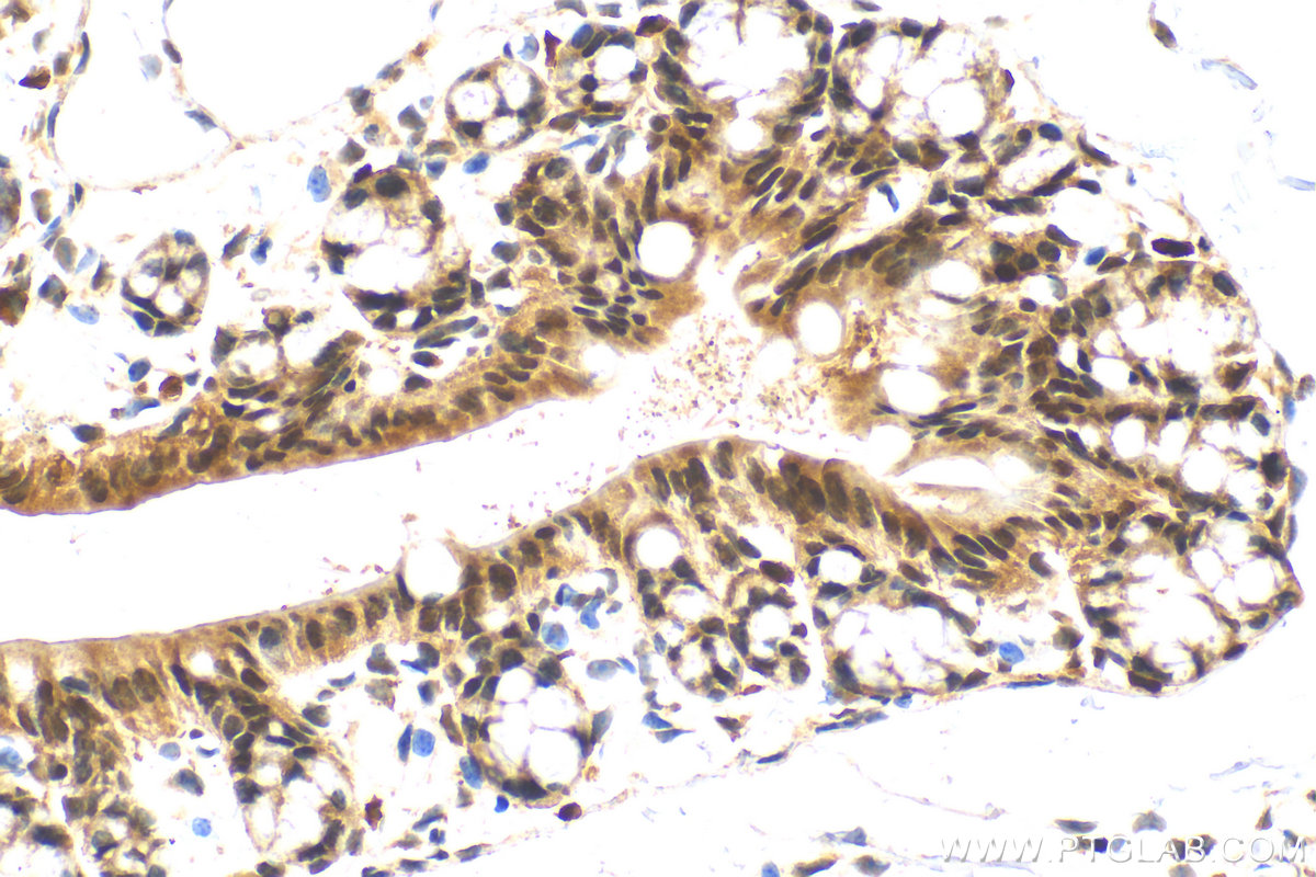 IHC staining of mouse colon using 22185-1-AP