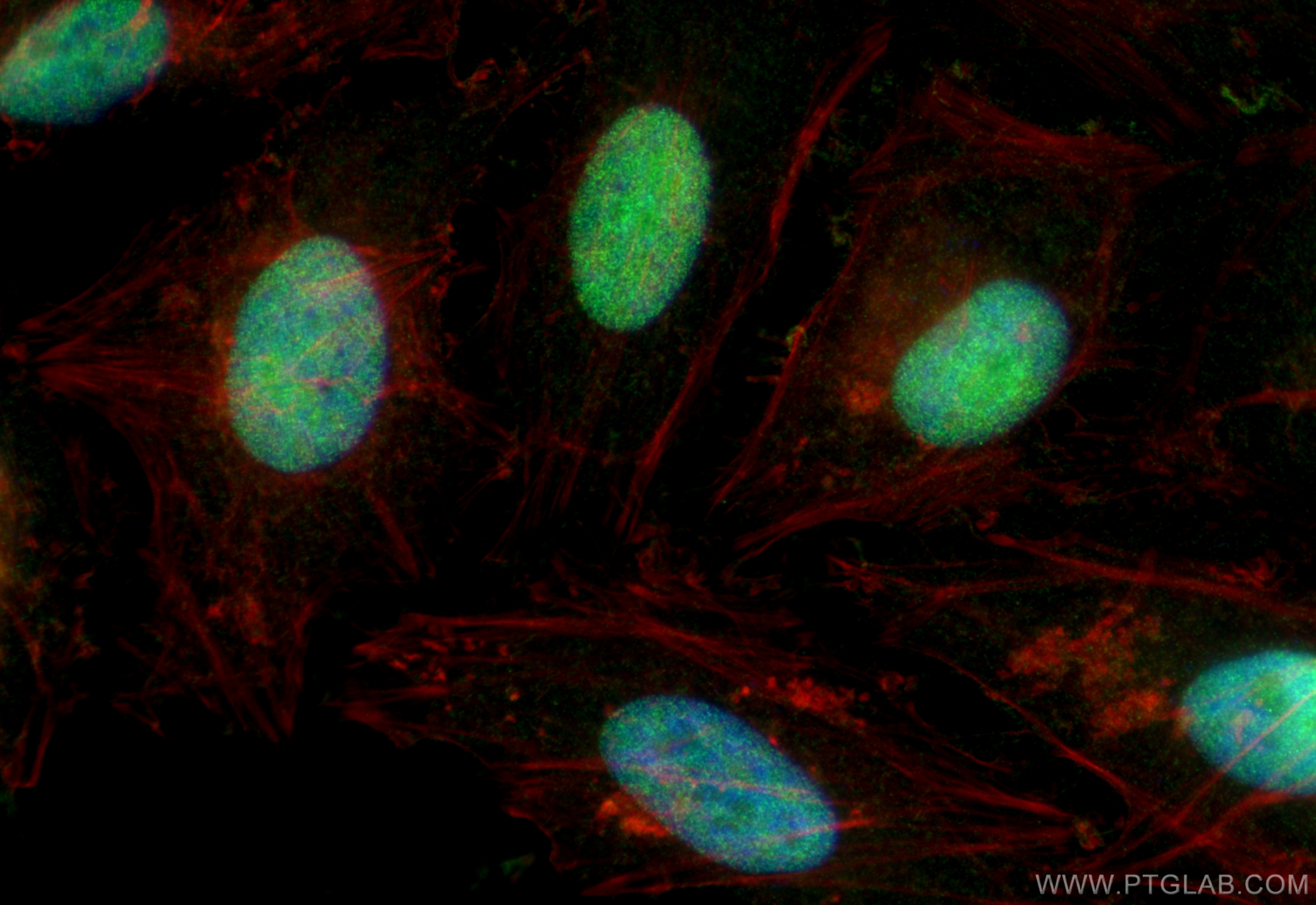 IF Staining of HeLa using 11720-1-AP