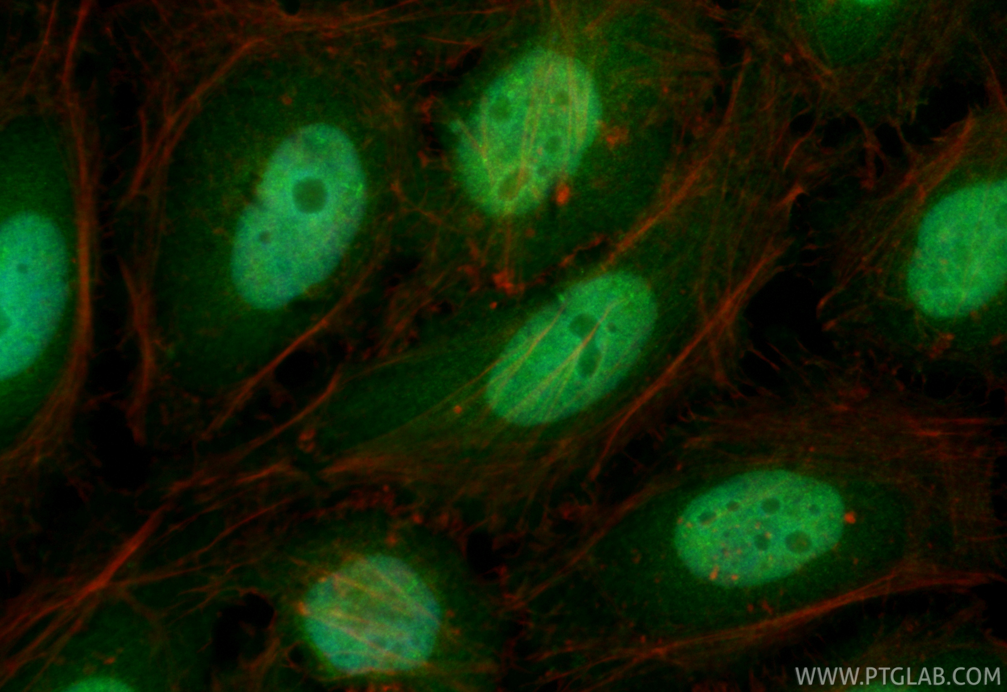 IF Staining of HeLa using CL488-85944-2