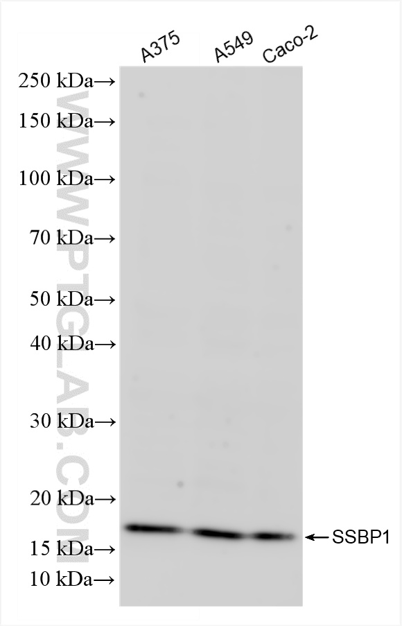 WB analysis using 84939-3-RR (same clone as 84939-3-PBS)