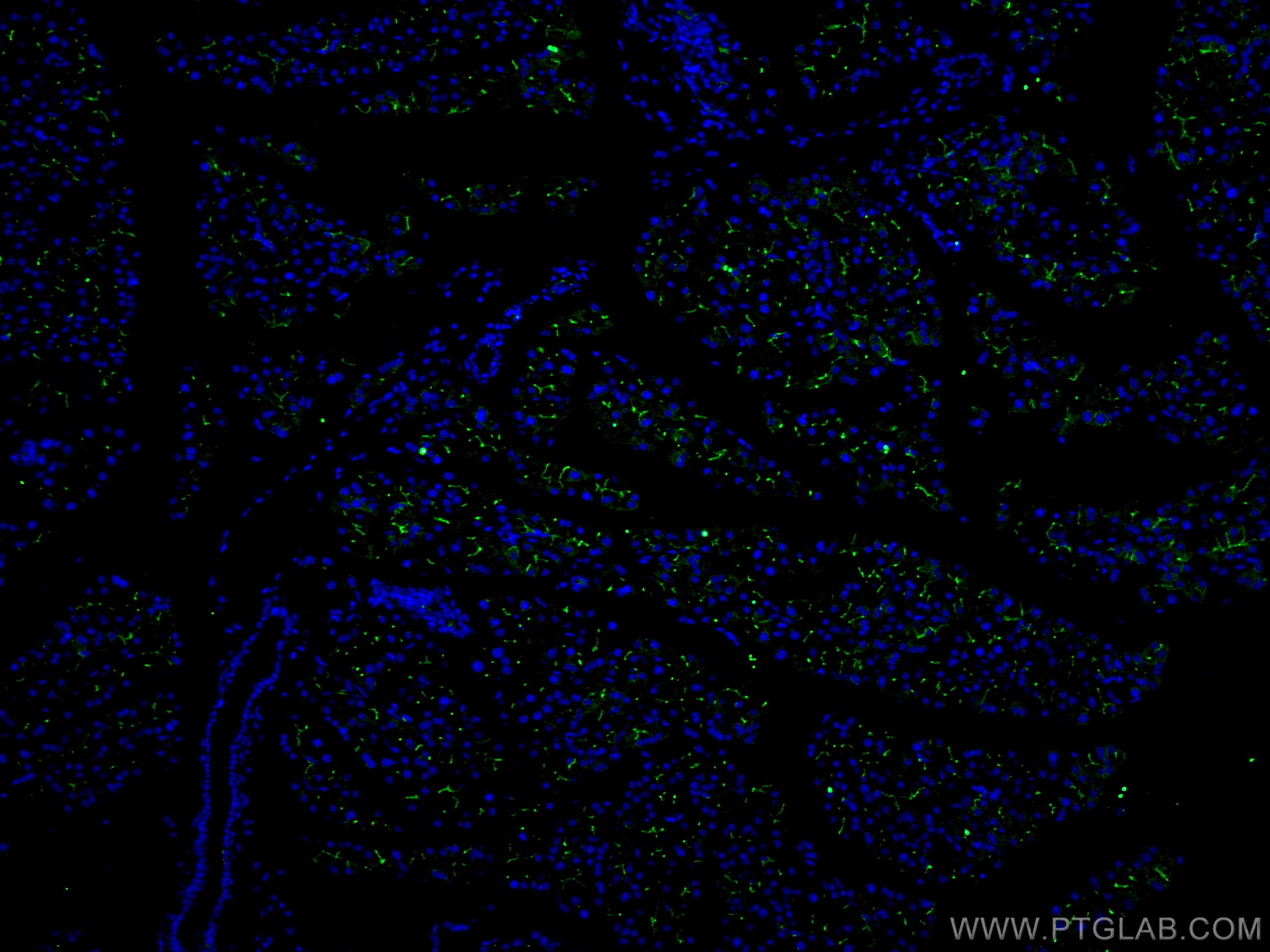 IF Staining of mouse pancreas using 14157-1-AP