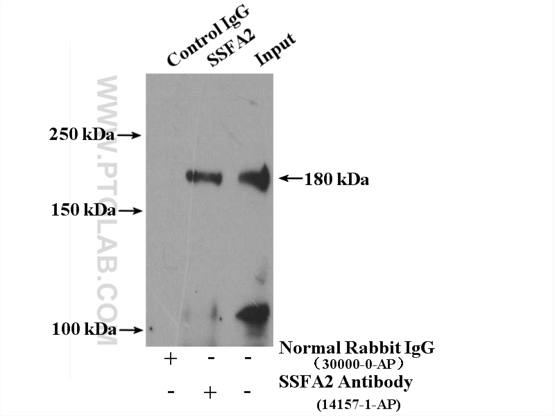 IP experiment of mouse testis using 14157-1-AP