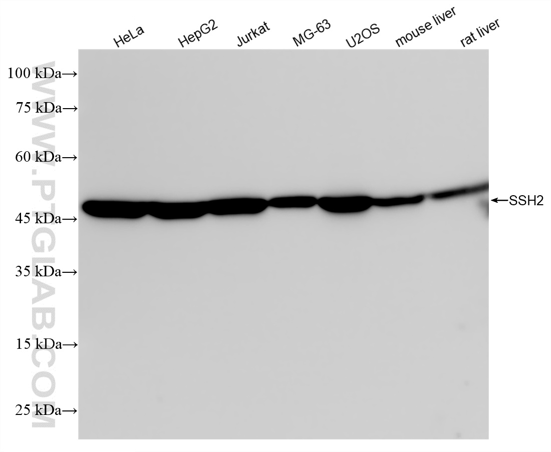 WB analysis using 85294-2-RR