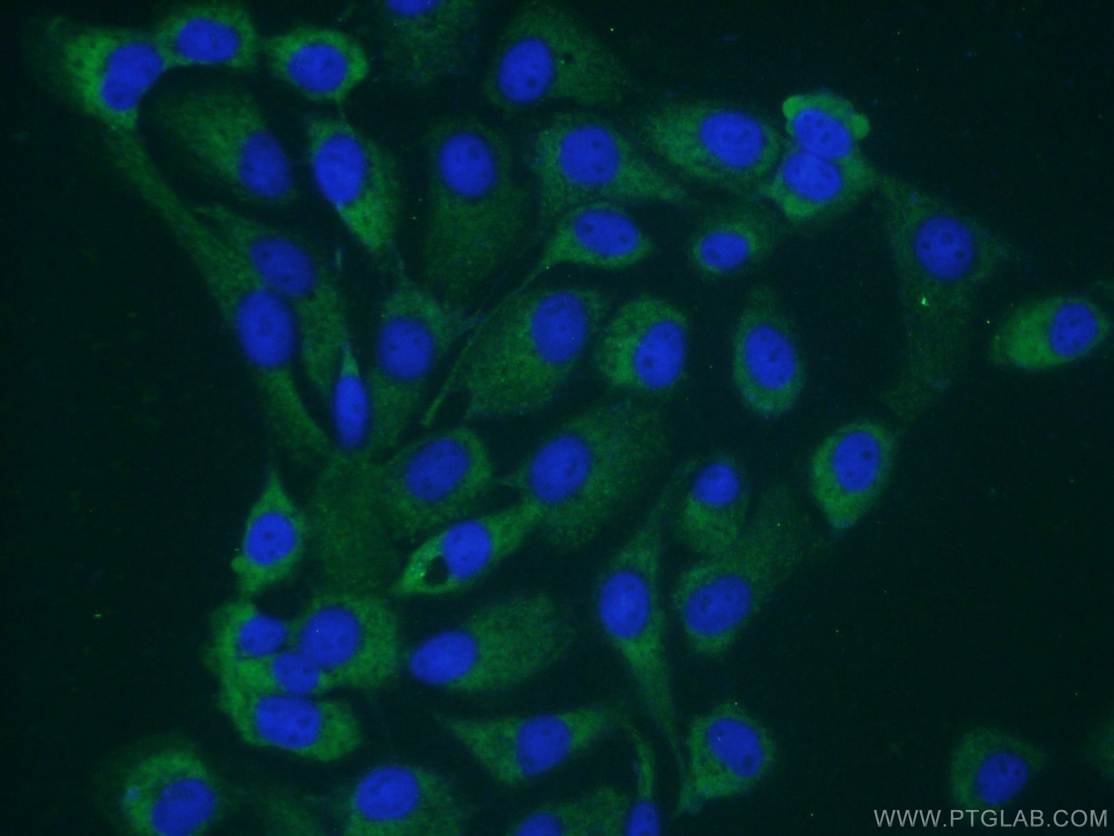 IF Staining of A431 using 18324-1-AP