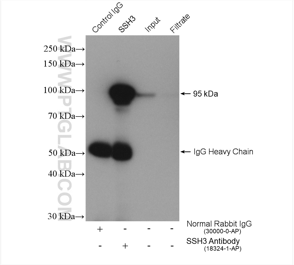 IP experiment of HeLa using 18324-1-AP