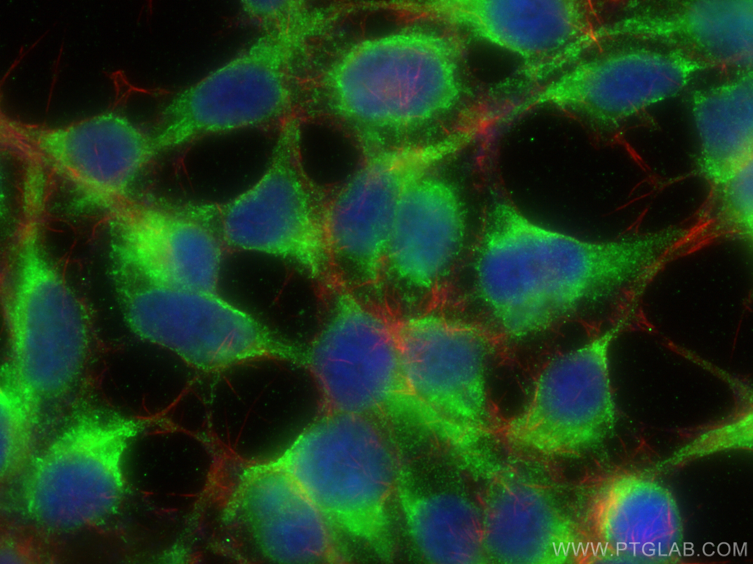 IF Staining of HEK-293 using 10583-1-AP