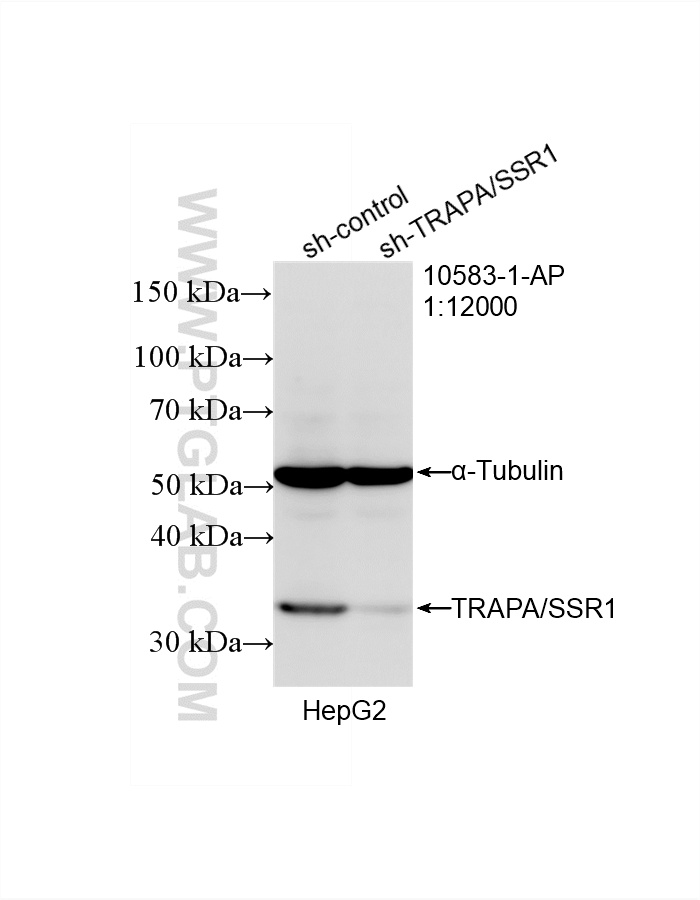 WB result of TRAPA/SSR1 antibody (10583-1-AP; 1:12000; incubated at room temperature for 1.5 hours) with sh-Control and sh-TRAPA/SSR1 transfected HepG2 cells. WB analysis of HepG2 using 10583-1-AP