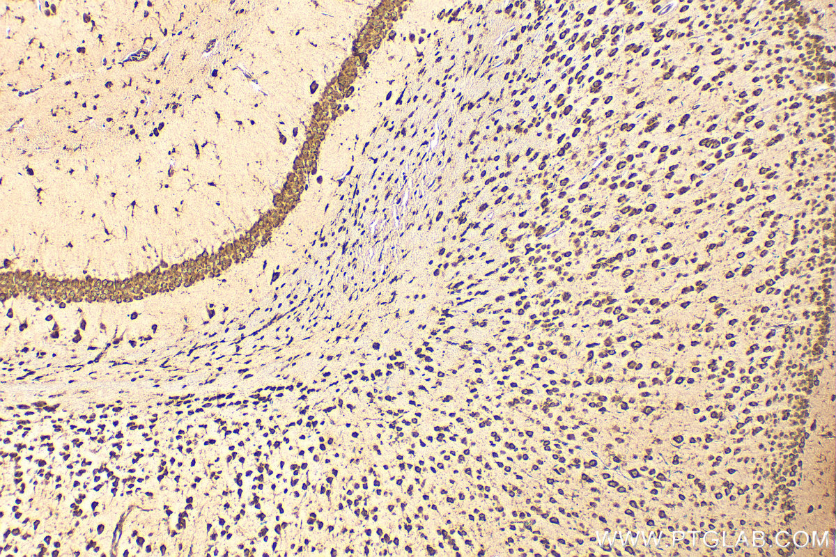 IHC staining of mouse brain using 30851-1-AP