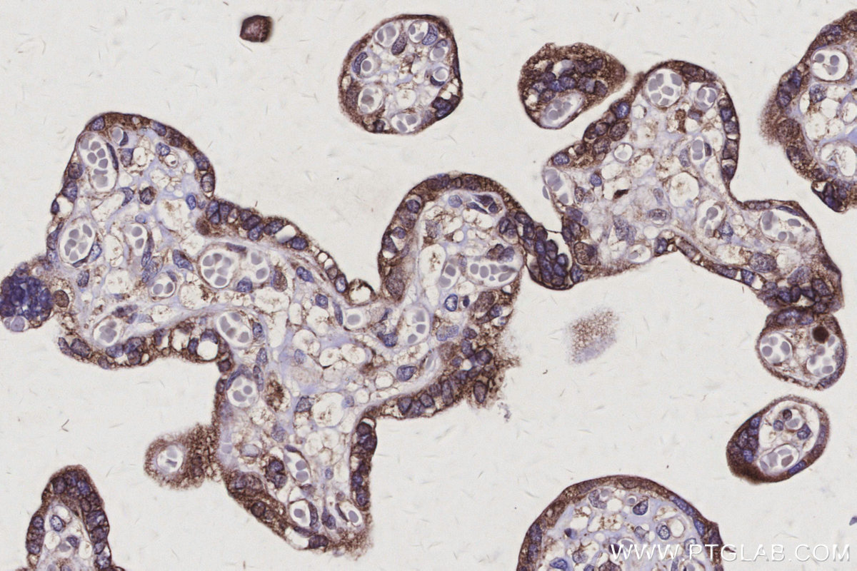 IHC staining of human placenta using 30851-1-AP IHC staining of human placenta using 30851-1-AP
