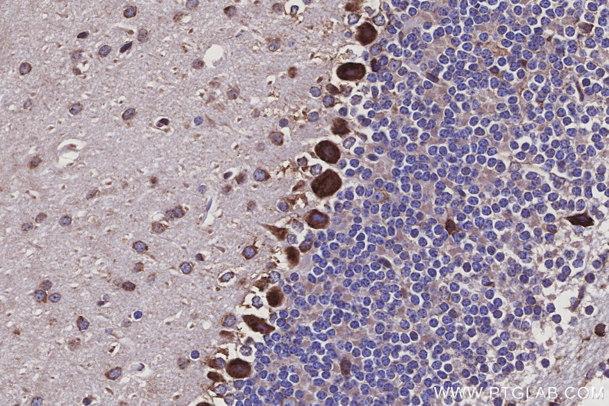 IHC staining of mouse cerebellum using 30851-1-AP IHC staining of mouse cerebellum using 30851-1-AP