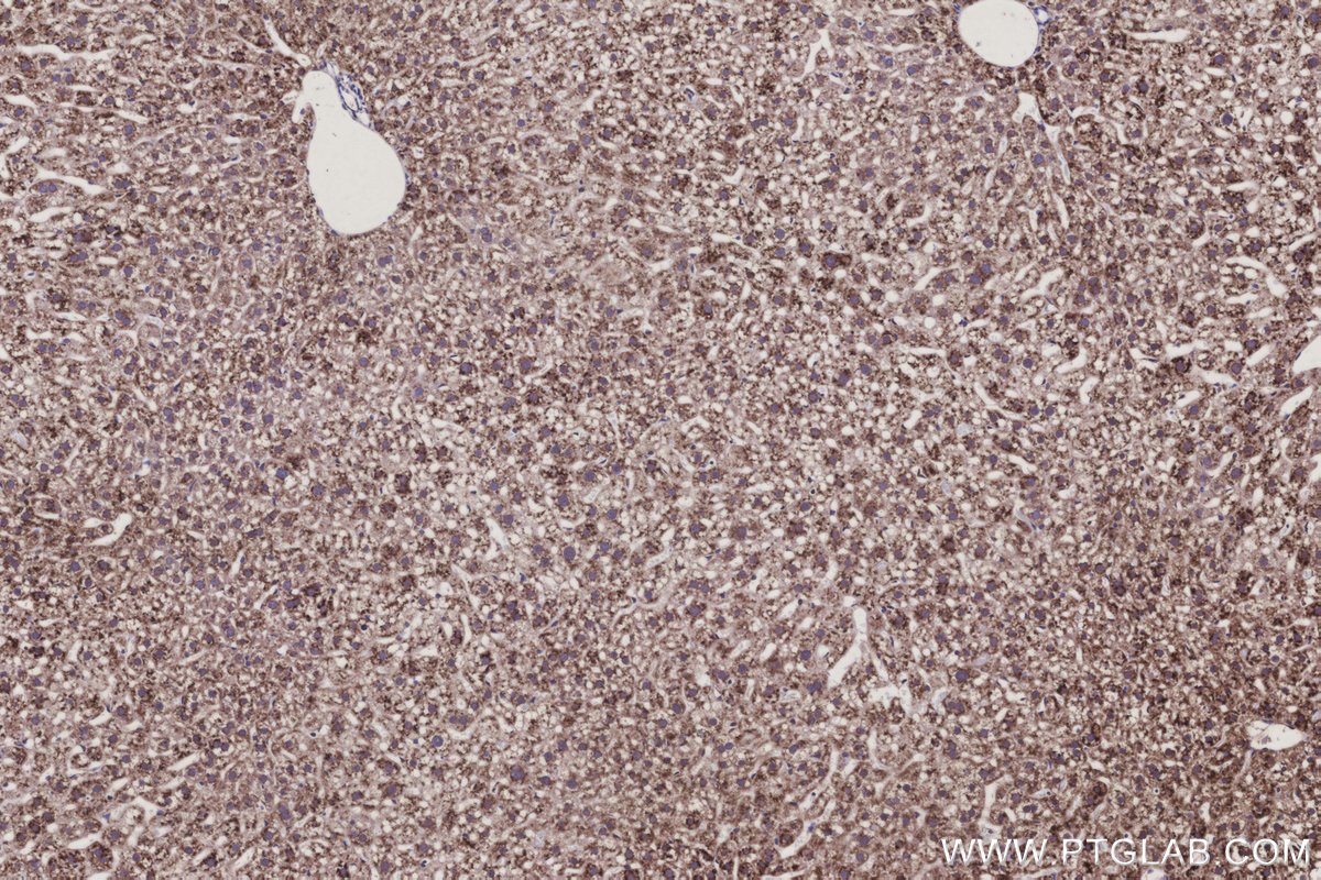IHC staining of mouse liver using 30851-1-AP IHC staining of mouse liver using 30851-1-AP