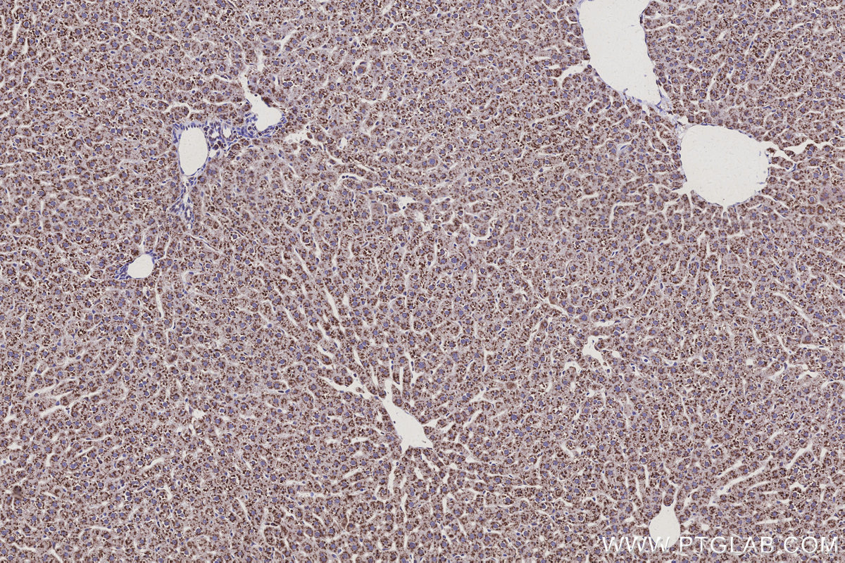 IHC staining of rat liver using 30851-1-AP IHC staining of rat liver using 30851-1-AP