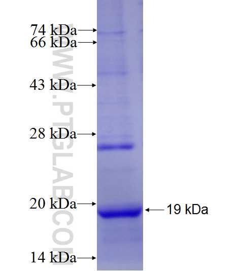 SSR3 fusion protein Ag8970 SDS-PAGE SSR3 fusion protein Ag8970 SDS-PAGE