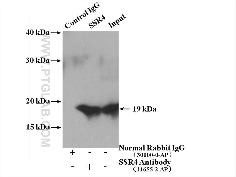 IP experiment of HeLa using 11655-2-AP