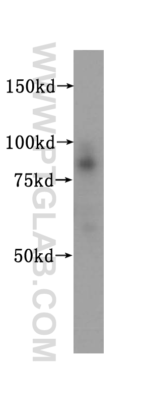 WB analysis of HeLa using 15696-1-AP