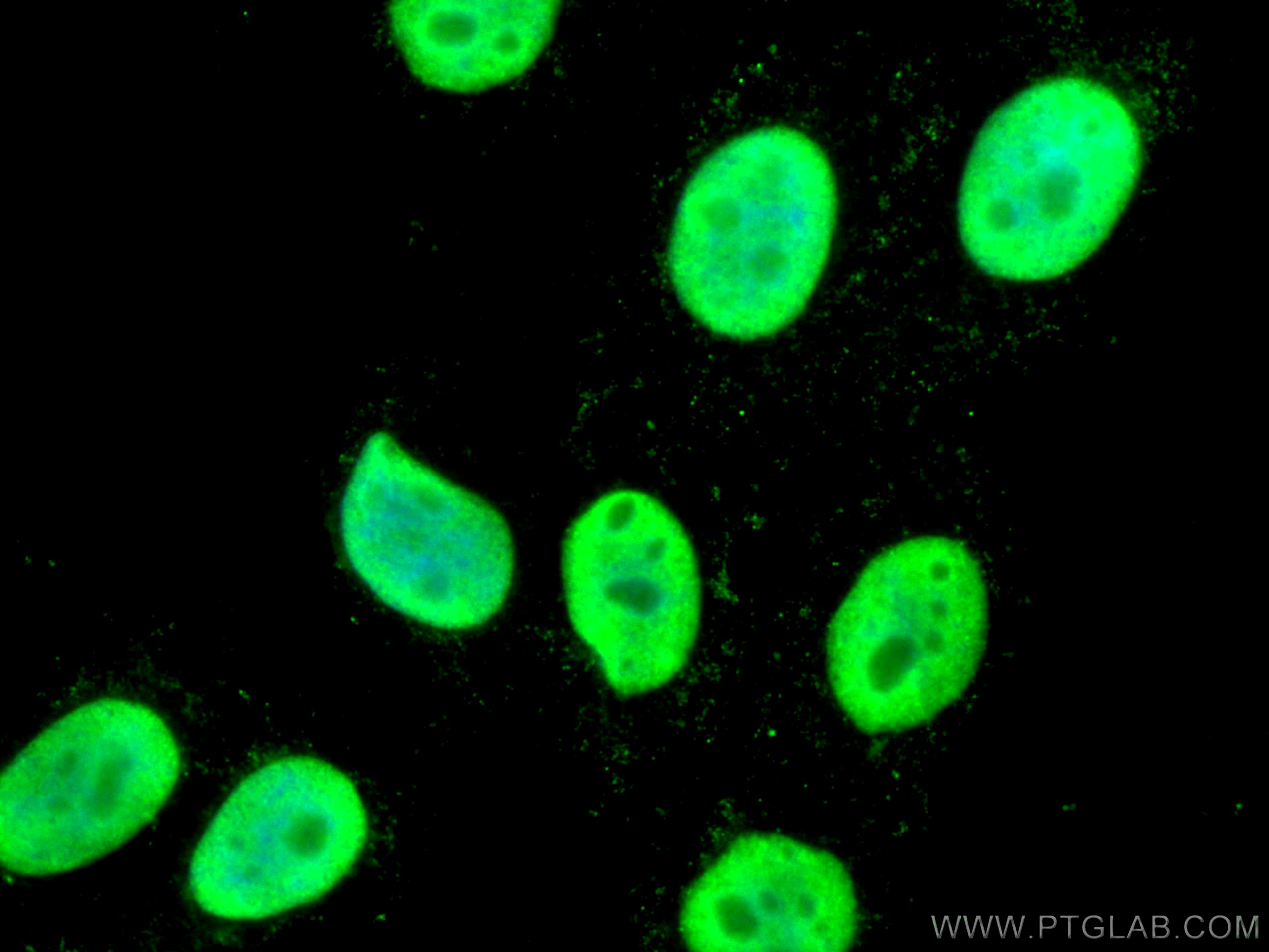 IF Staining of HepG2 using 67313-1-Ig