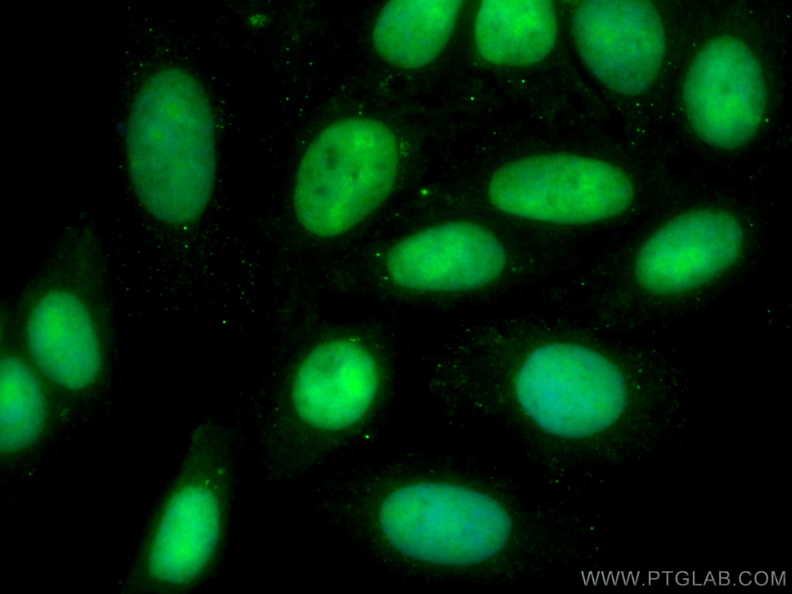 IF Staining of HepG2 using CL488-67313