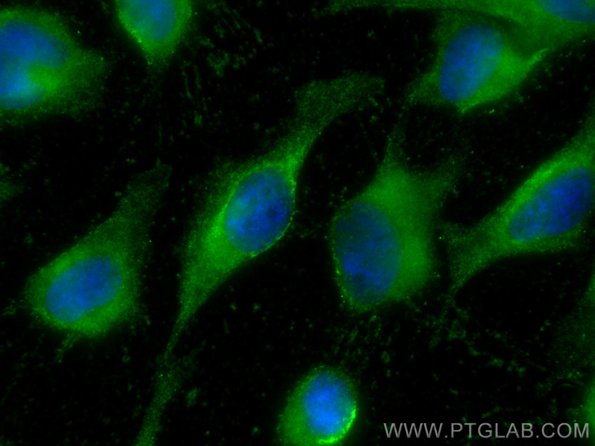 IF Staining of HeLa using 68423-1-Ig