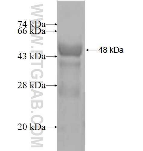 SSSCA1 fusion protein Ag2916 SDS-PAGE