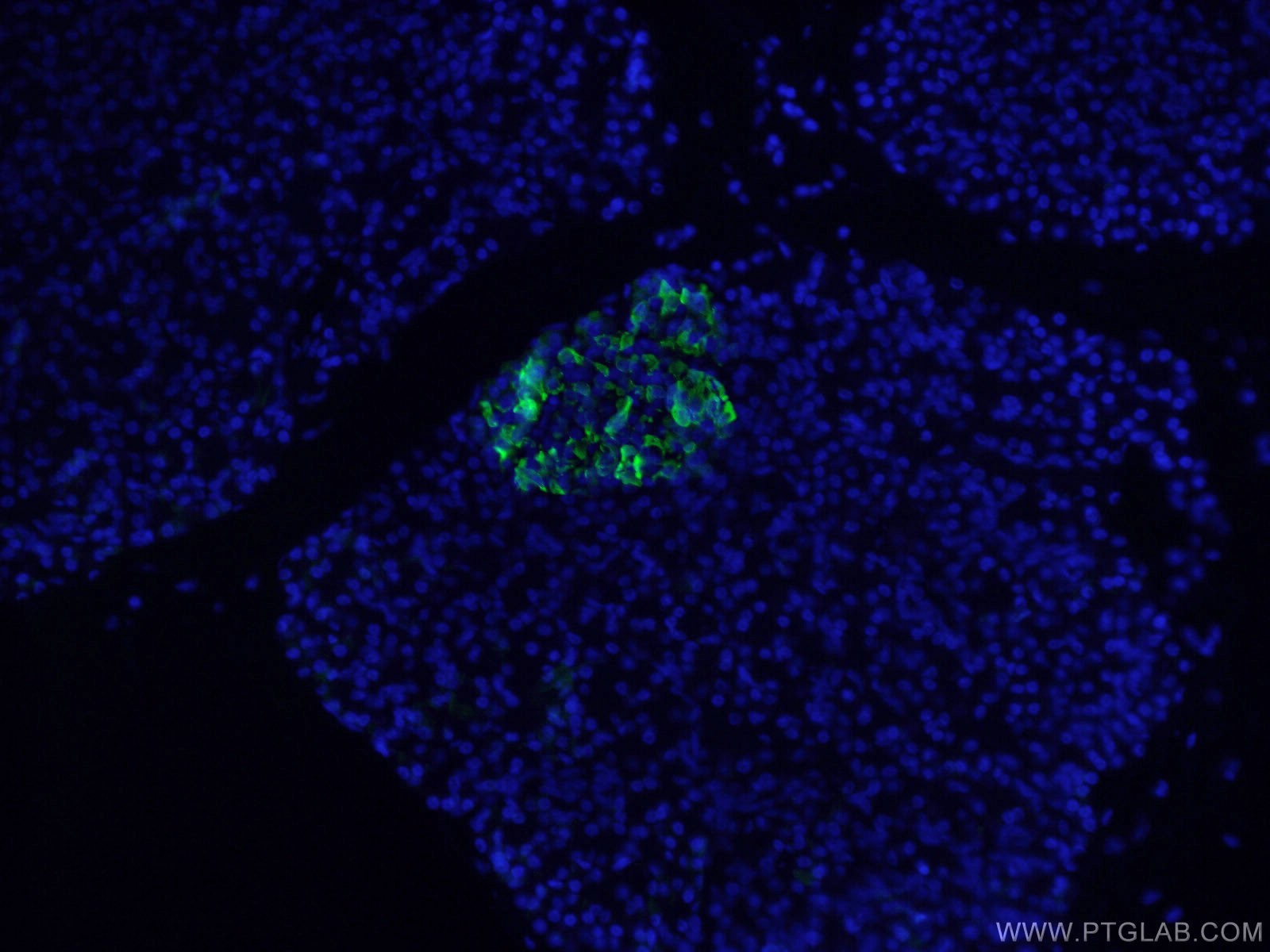 IF Staining of human pancreas using 17512-1-AP