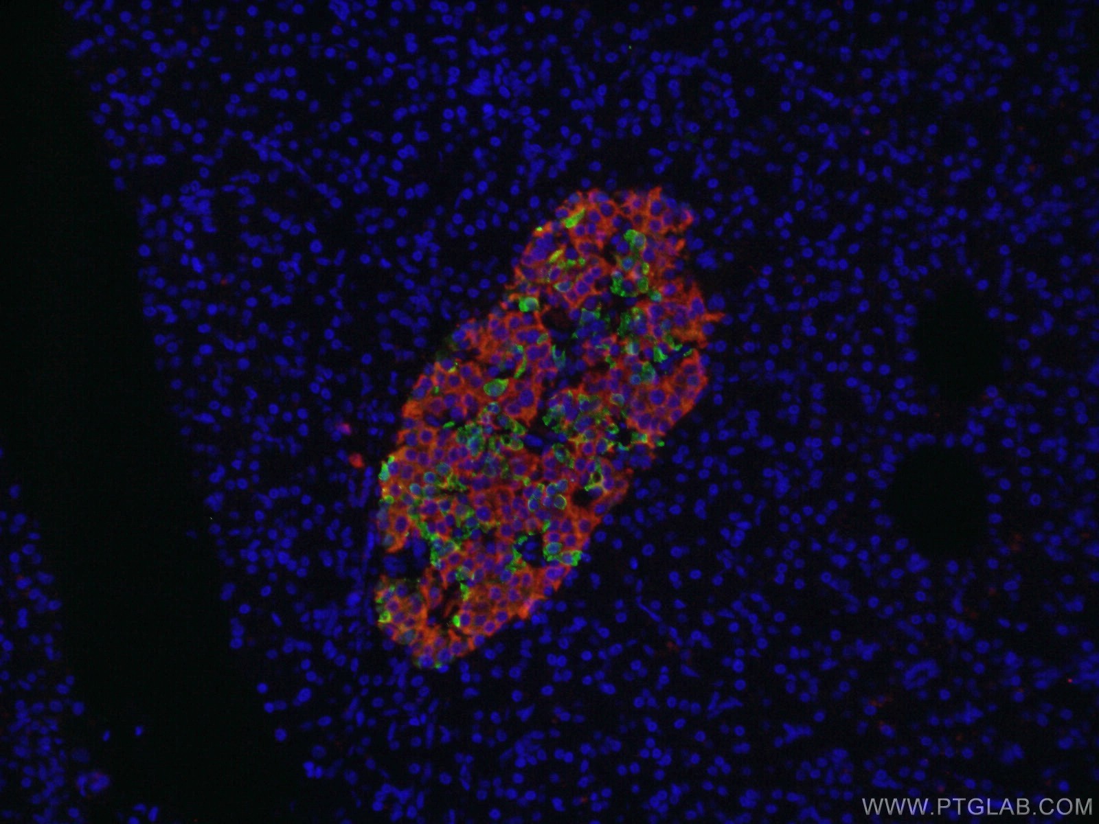 IF Staining of human pancreas using 17512-1-AP