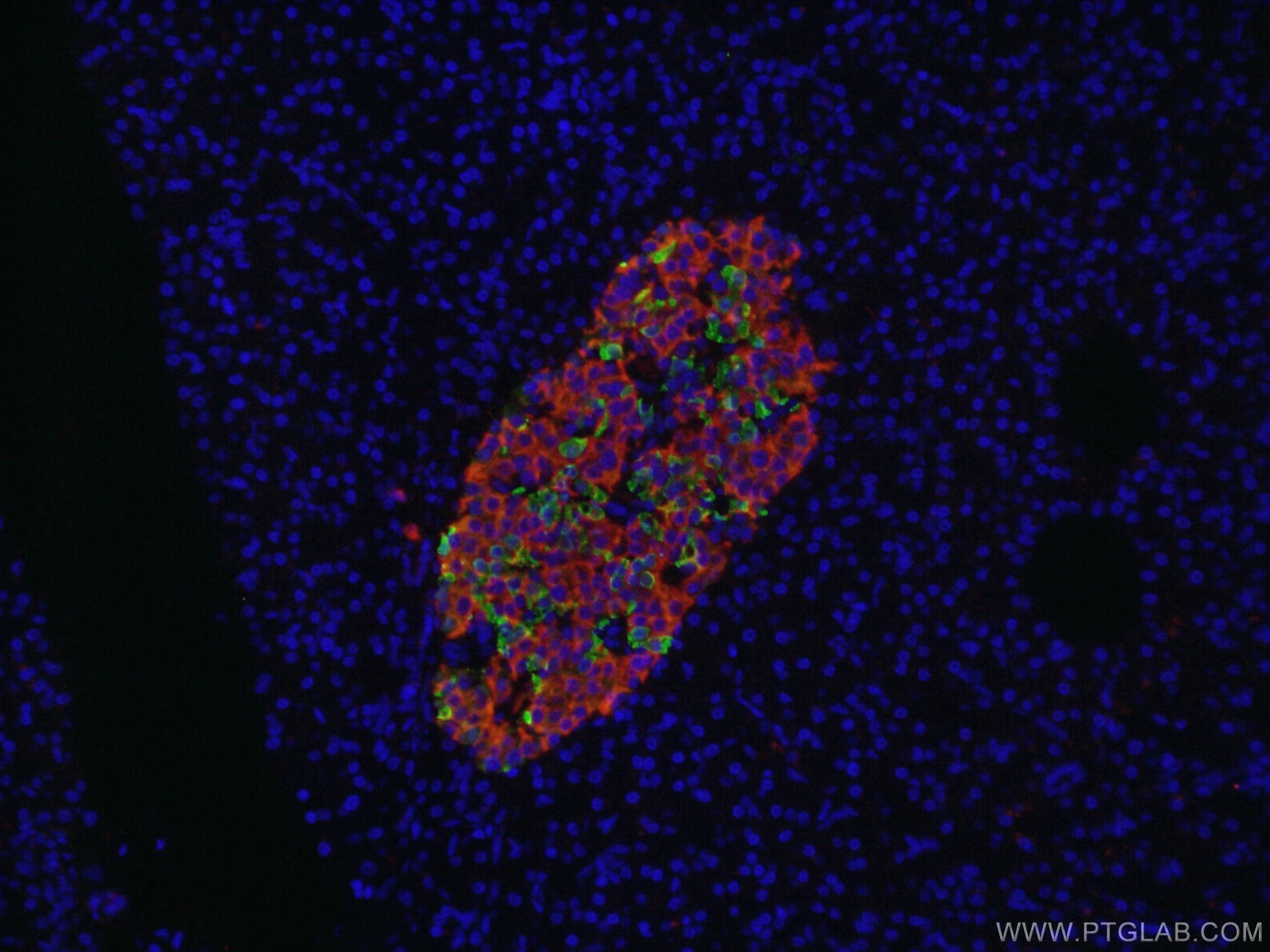 IF Staining of human pancreas using 17512-1-AP