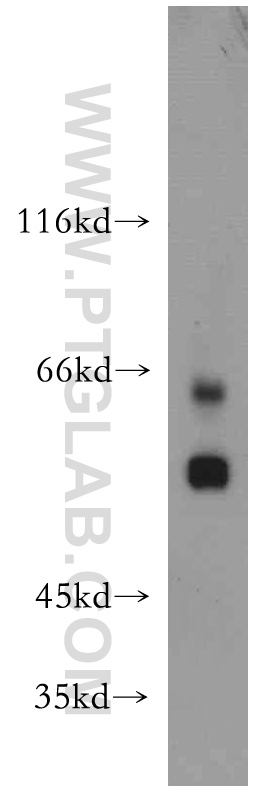 WB analysis of L02 using 20587-1-AP