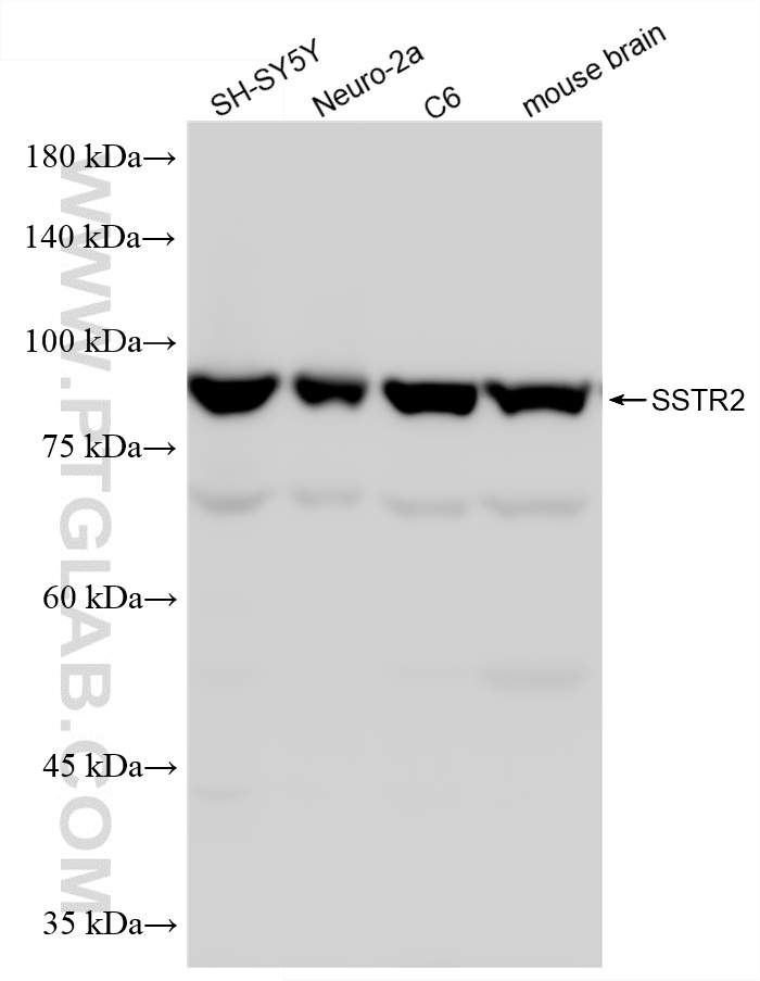 WB analysis using 87663-1-RR