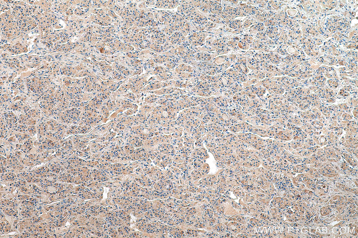 IHC staining of human pituitary using 20696-1-AP
