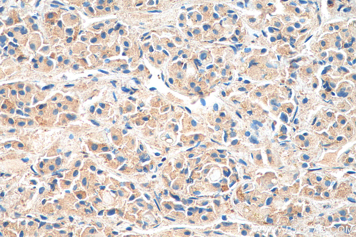 IHC staining of human pituitary using 20696-1-AP
