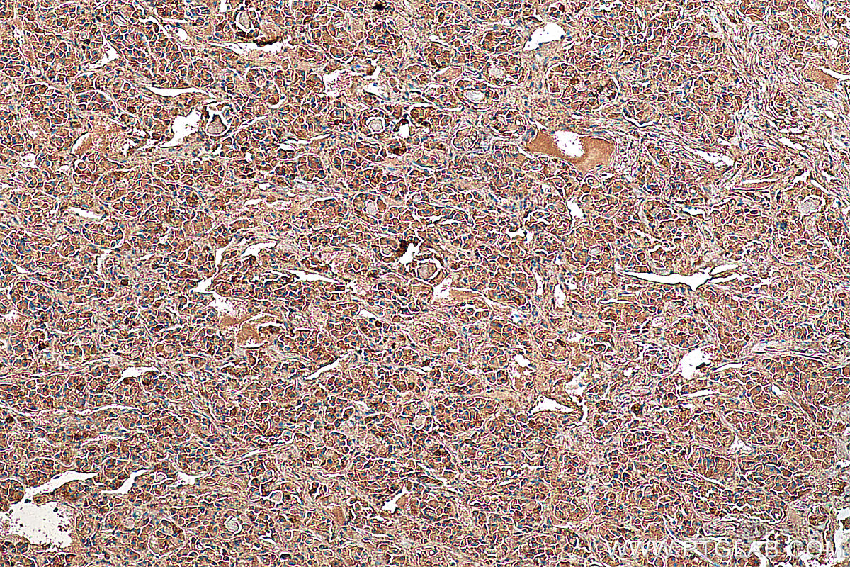 IHC staining of human pituitary using 20696-1-AP
