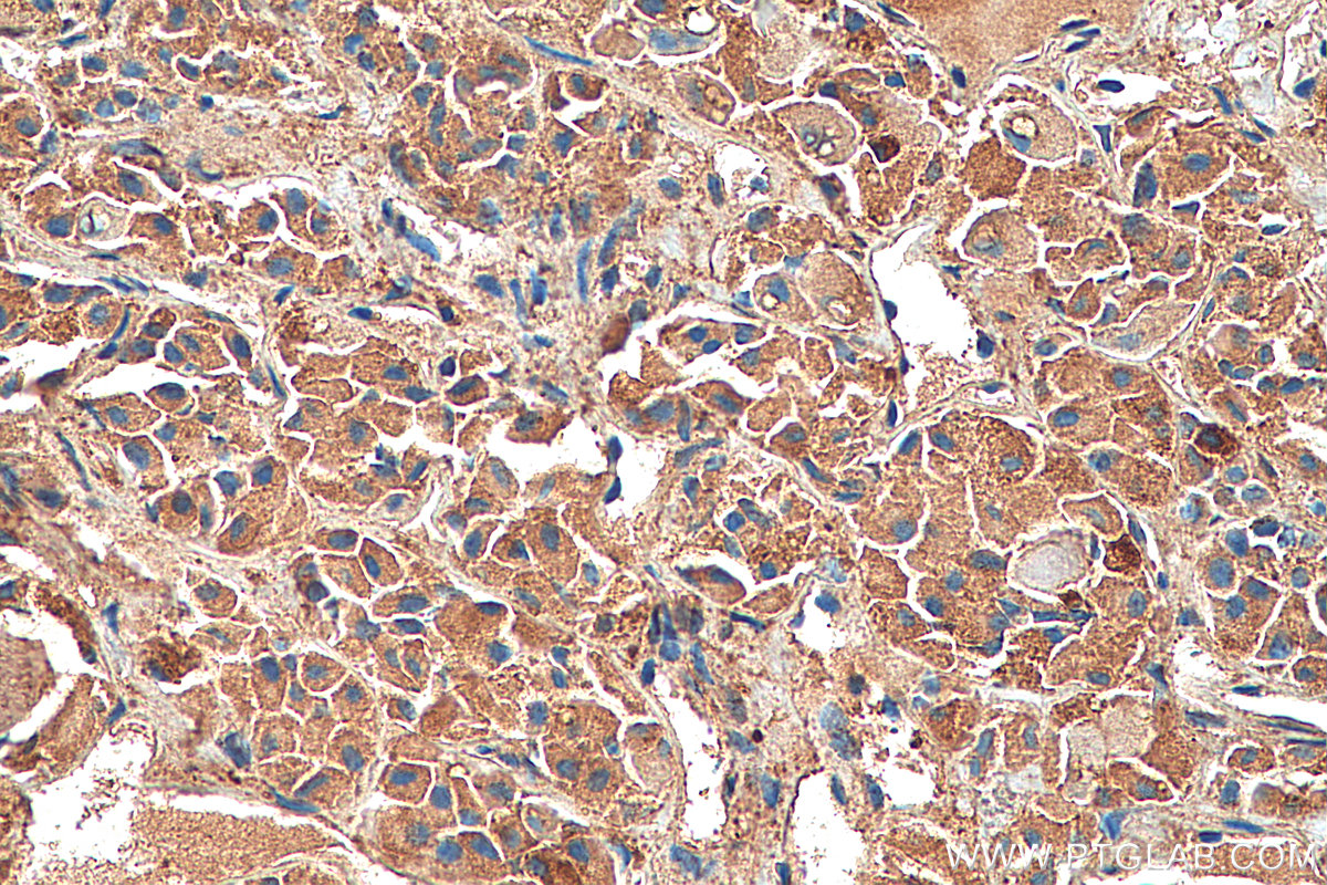 IHC staining of human pituitary using 20696-1-AP