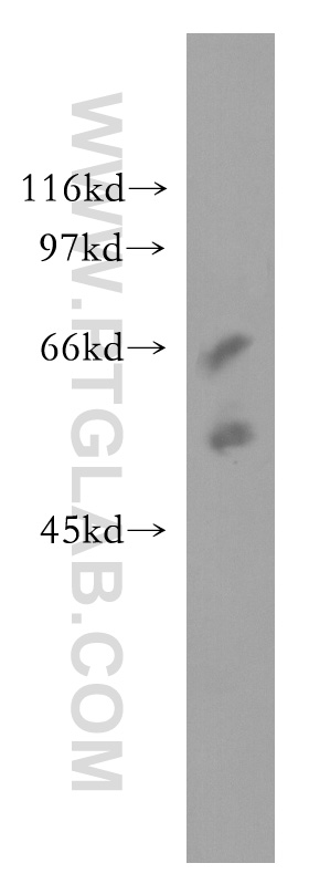 WB analysis of human placenta using 51029-2-AP