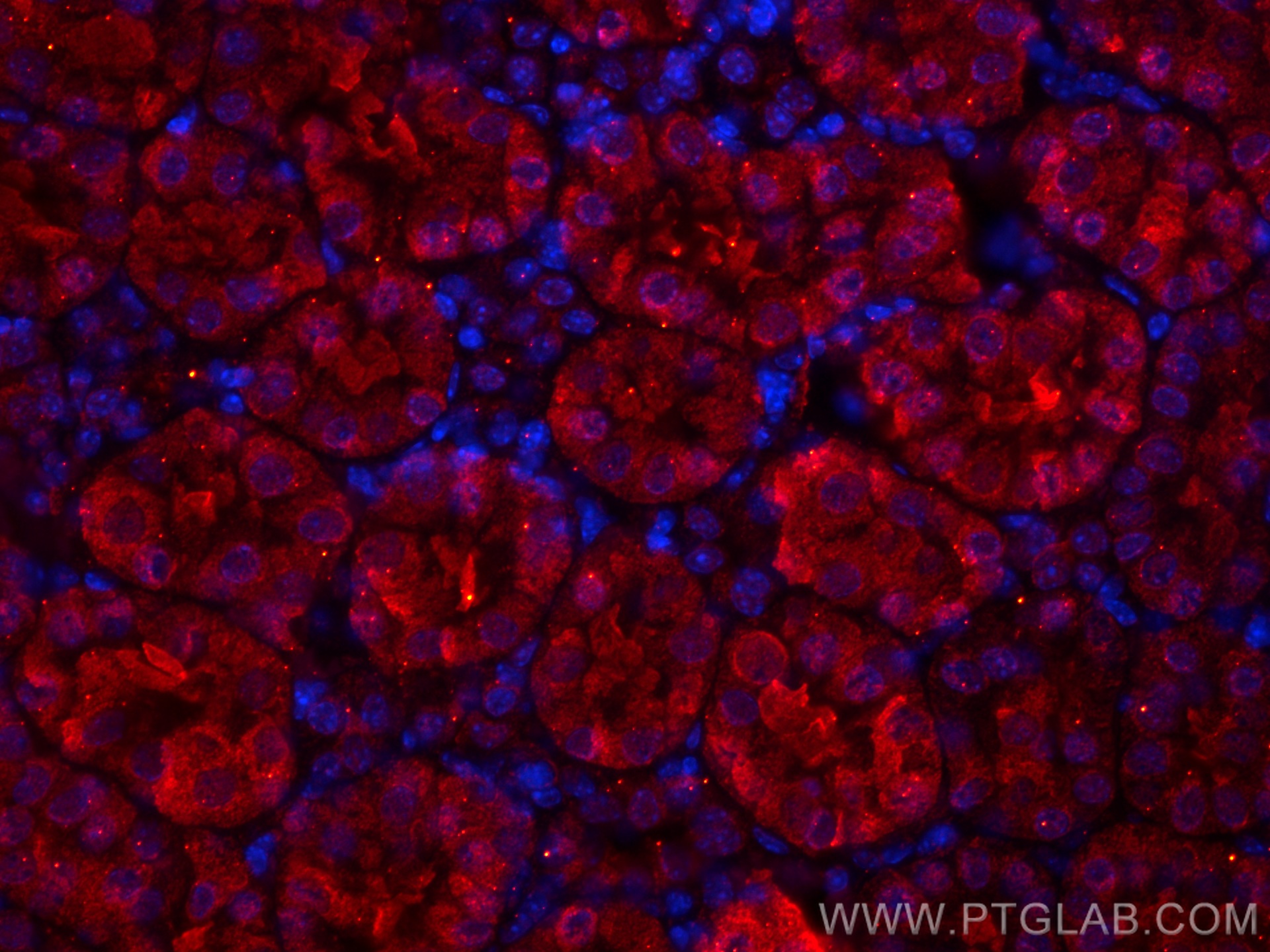 IF Staining of mouse kidney using CL594-66772