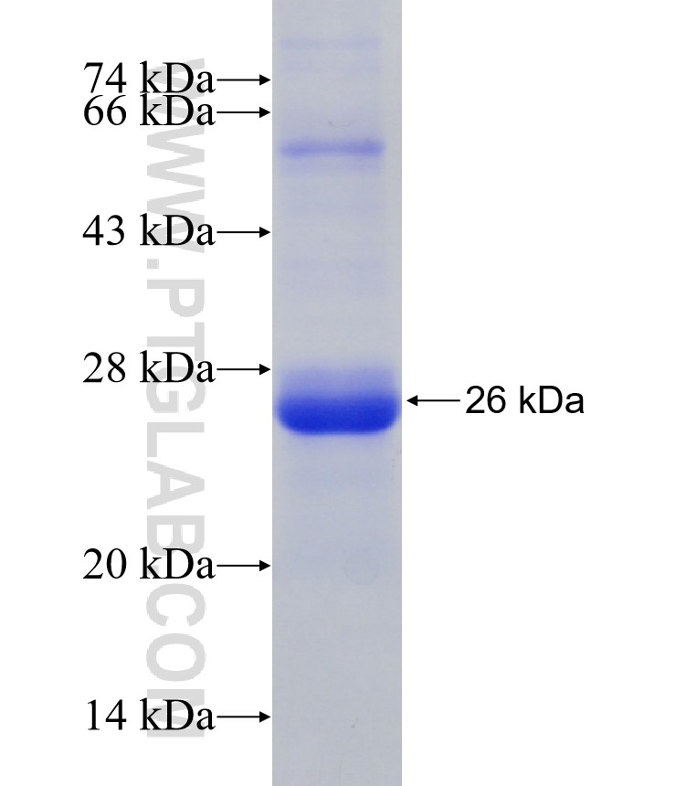 SSX2 fusion protein Ag30887 SDS-PAGE