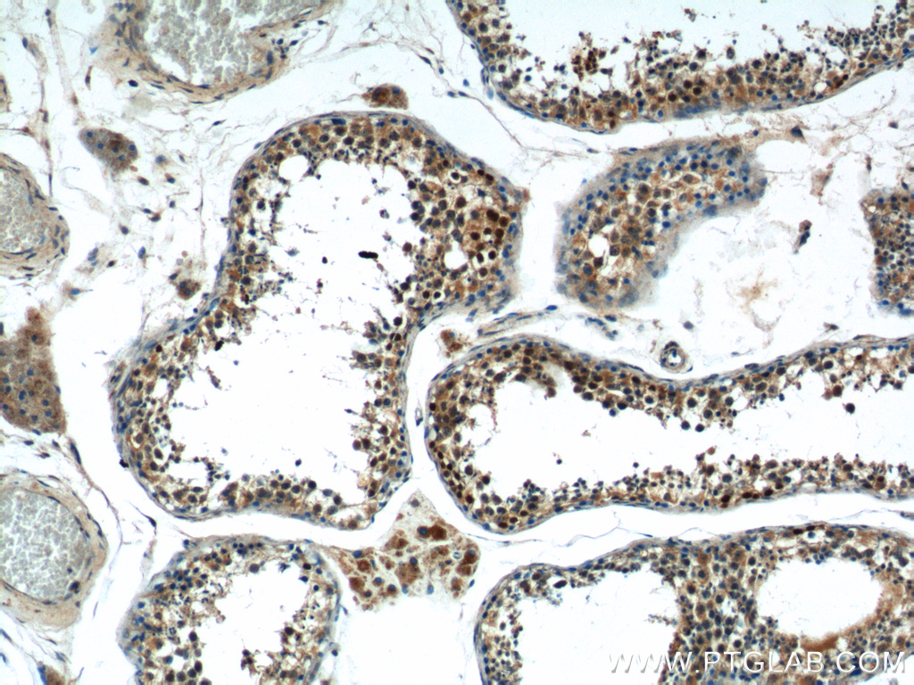 IHC staining of human testis using 15876-1-AP