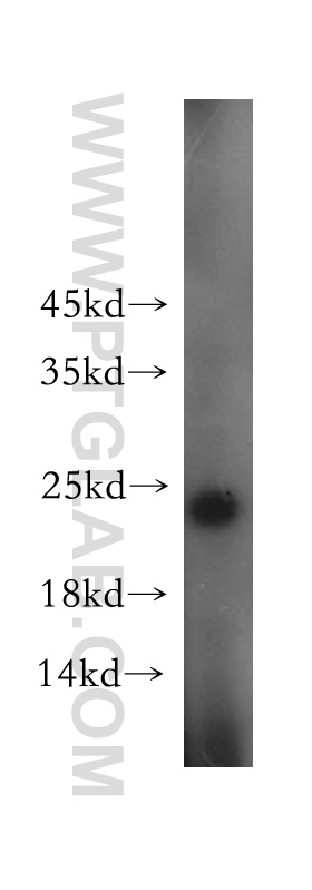 WB analysis of MCF-7 using 15876-1-AP