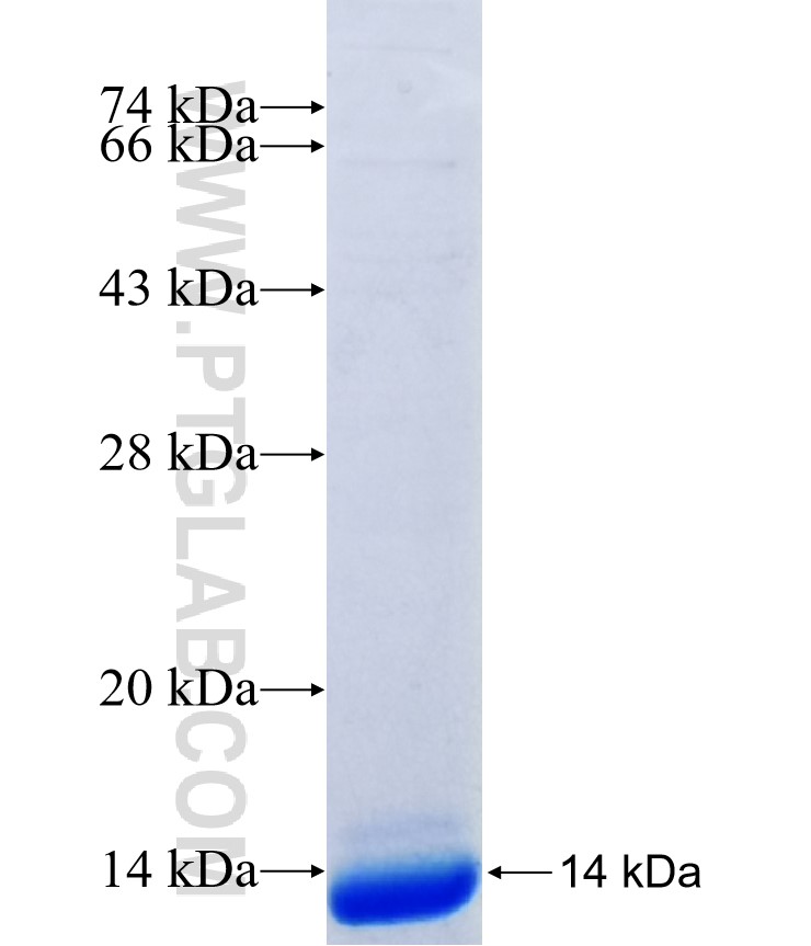 SSX4B fusion protein Ag37027 SDS-PAGE SSX4B fusion protein Ag37027 SDS-PAGE