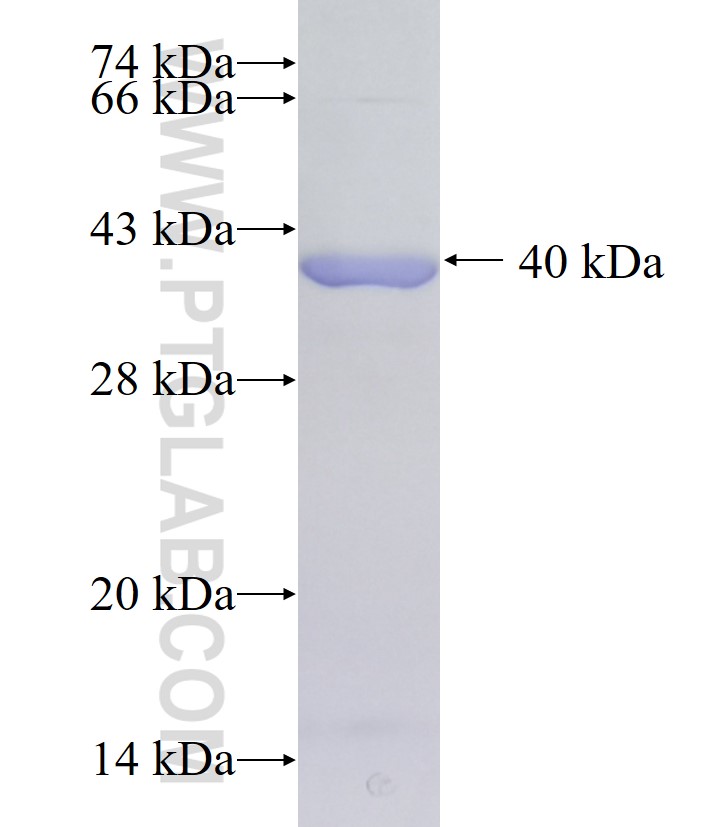 ST13 fusion protein Ag36889 SDS-PAGE ST13 fusion protein Ag36889 SDS-PAGE