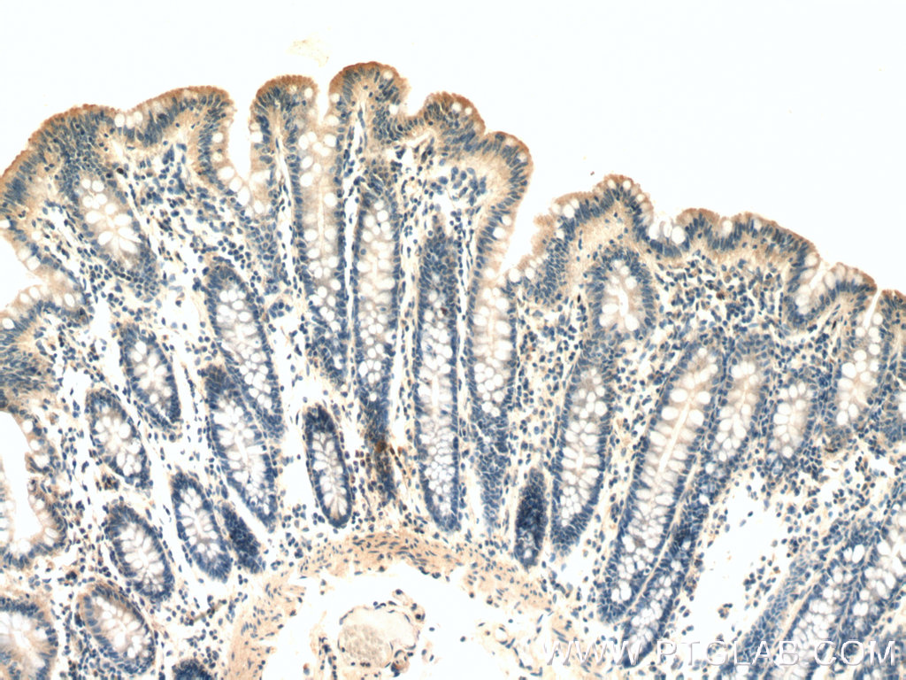 IHC staining of human colon using 27176-1-AP