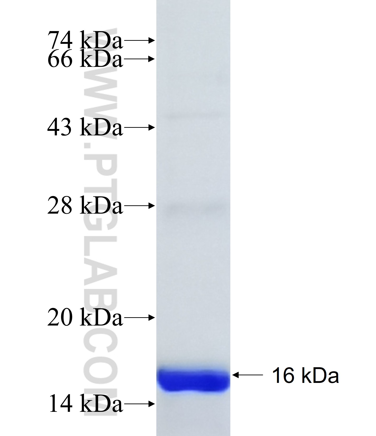 ST18 fusion protein Ag40938 SDS-PAGE ST18 fusion protein Ag40938 SDS-PAGE