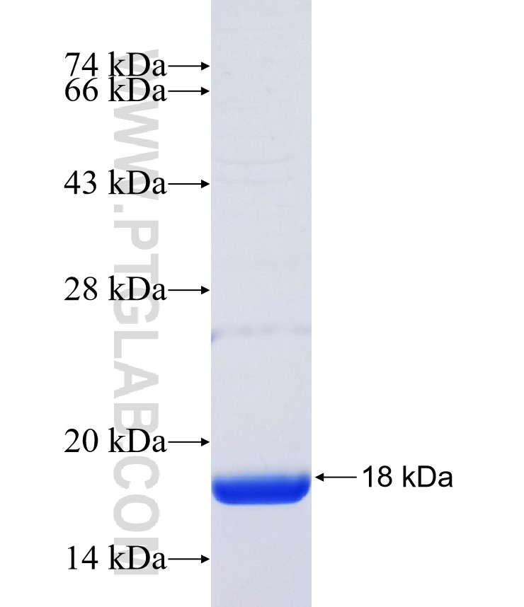 ST3GAL1 fusion protein Ag37316 SDS-PAGE ST3GAL1 fusion protein Ag37316 SDS-PAGE