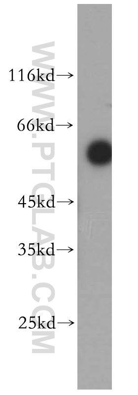 WB analysis of human colon using 13620-1-AP