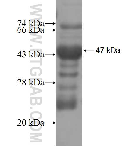 ST3GAL2 fusion protein Ag4528 SDS-PAGE