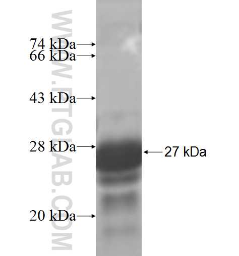 ST3GAL2 fusion protein Ag4721 SDS-PAGE