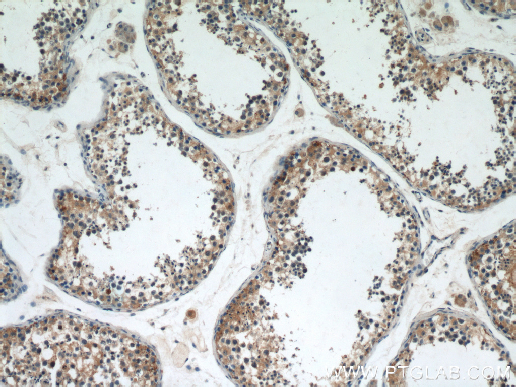 IHC staining of human testis using 13546-1-AP