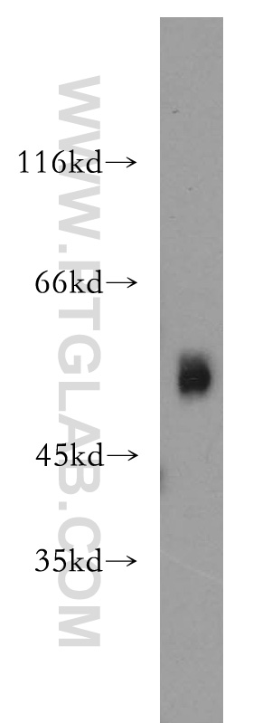 ST3GAL4 Polyclonal antibody