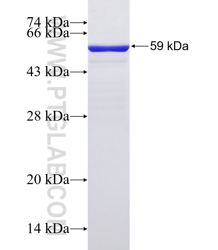 ST3GAL4 fusion protein Ag3665 SDS-PAGE