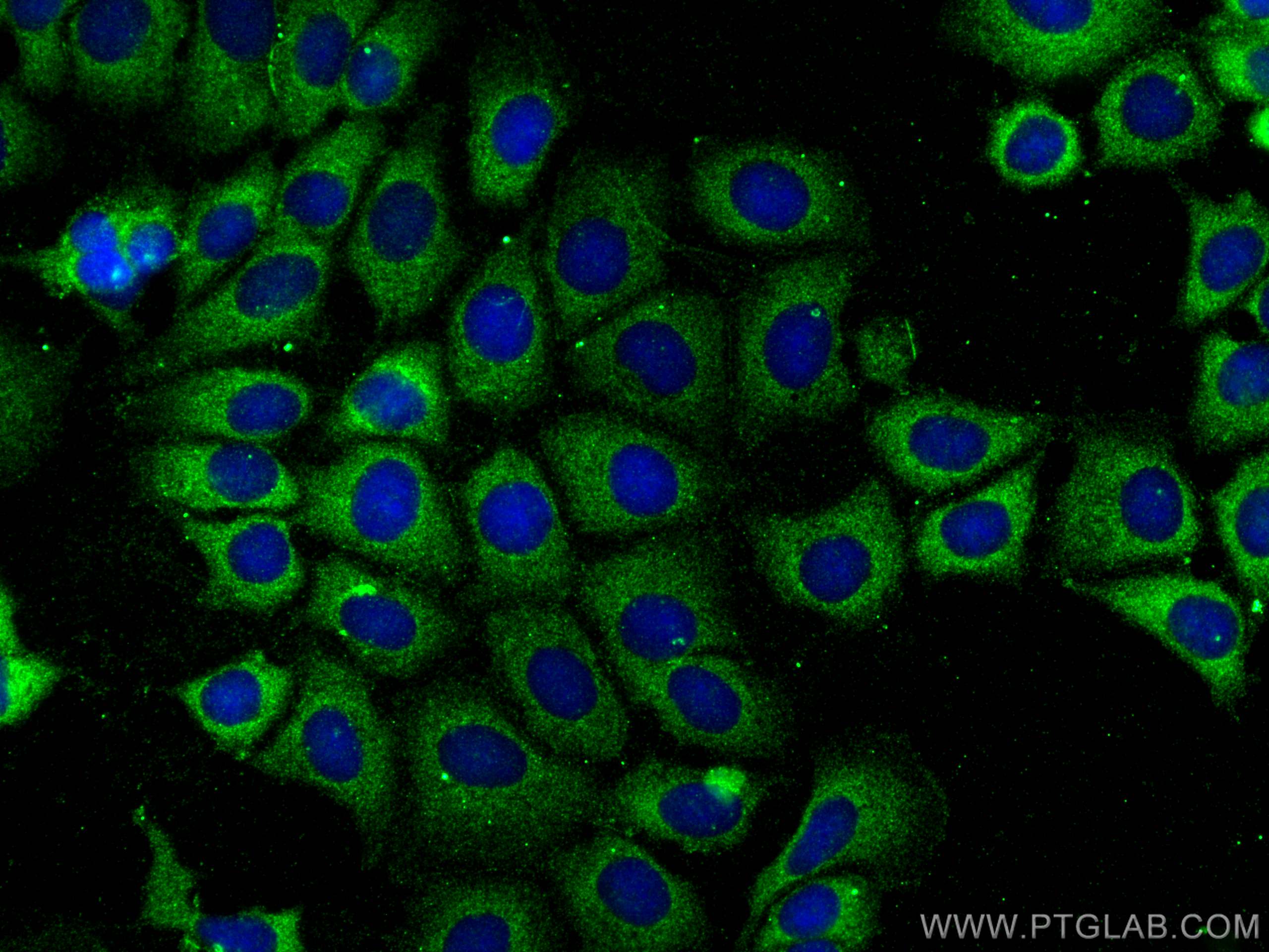 IF Staining of U2OS using 30120-1-AP